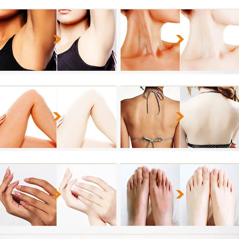 Whitening Cream Private Parts Underarm Butt Knee Whiten Inner Thigh Intimate Parts Dark Remove Melanin Woman Brighten Skin Care - GilloServ